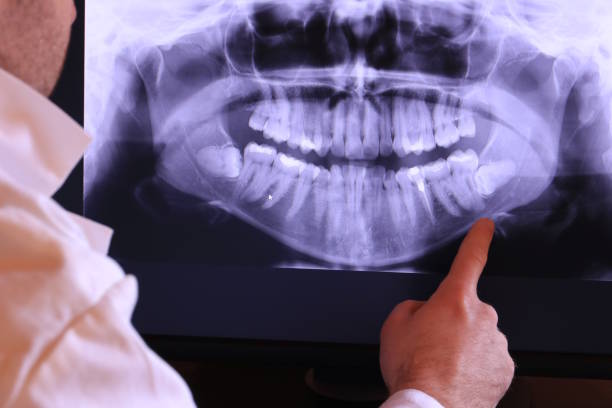 Best Walk-In Emergency Dentist in Dermott, AR