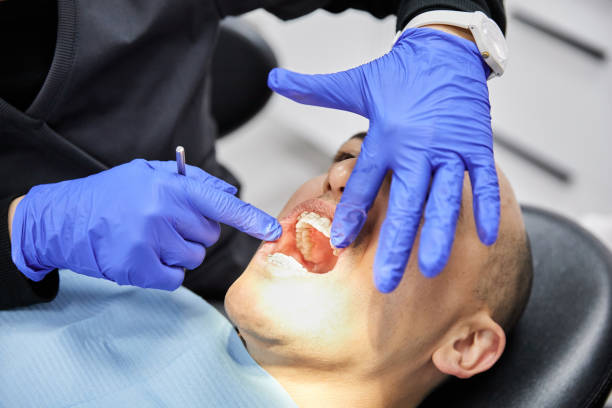 Best Emergency Wisdom Teeth Removal in Dermott, AR