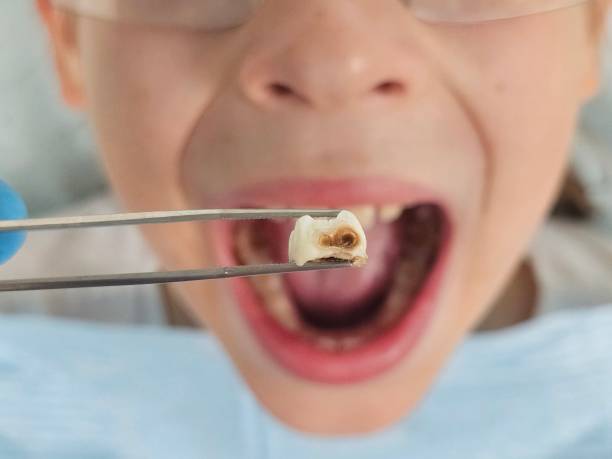 Best Emergency Dental Care for Trauma or Injury in Dermott, AR